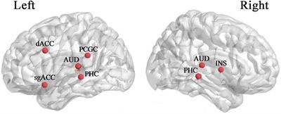 Objective Recognition of Tinnitus Location Using Electroencephalography Connectivity Features
